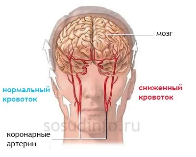Гімнастика і вправи для серця і судин мозку, ніг і шиї (судин) Гімнастика і вправи для серця і судин мозку, ніг і шиї