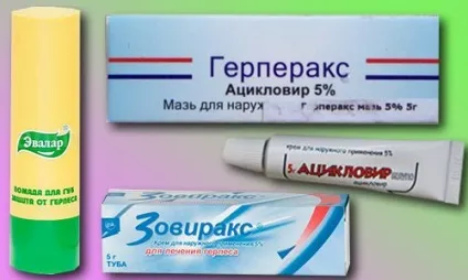 Герпес на губах причини виникнення та лікування (виникнення) Герпес на губах причини виникнення та лікування