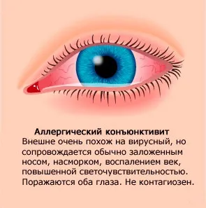 Очні краплі кромогексал опис, протипоказання, застосування (протиалергічний засіб) Очні краплі кромогексал опис, протипоказання, застосування