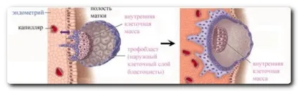 Імплантація триденних ембріонів (відео) (триденних) Імплантація триденних ембріонів (відео)