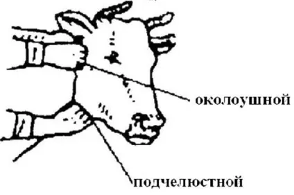 Дослідження лімфатичних вузлів (Дослідження лімфатичних вузлів) Дослідження лімфатичних вузлів