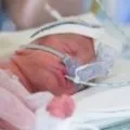 Як визначити запалення легенів у дітей симптоми, ознаки та лікування (запалення легенів у дітей лікування) Як визначити запалення легенів у дітей симптоми, ознаки та лікування