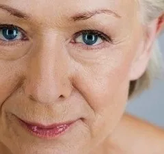 Як прибрати Носослізний борозну методи - апаратна косметологія (прибрати) Як прибрати Носослізний борозну методи - апаратна косметологія