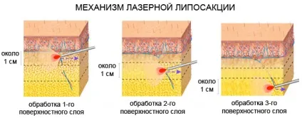 Як прибрати жир з рук всі найефективніші способи спалювання жиру в одному місці (ефективні) Як прибрати жир з рук всі найефективніші способи спалювання жиру в одному місці