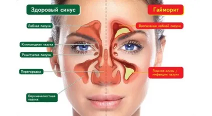 Як вивести слиз з організму і стати здоровішими на 10 років, доктор борис увайдов (доктор) Як вивести слиз з організму і стати здоровішими на 10 років, доктор борис увайдов