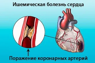 Кардіопатія у дітей - причини і лікування функціональної, вторинної та вродженої патології (причини) Кардіопатія у дітей - причини і лікування функціональної, вторинної та вродженої патології