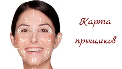 Карта прищів на обличчі, що означають різні зони прищів (означають) Карта прищів на обличчі, що означають різні зони прищів
