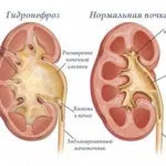 Коли можна сіль для немовлят (немовлят) Коли можна сіль для немовлят