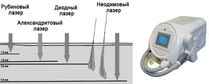 Корекція татуювання мистецтво виправляти помилки (мистецтво) Корекція татуювання мистецтво виправляти помилки