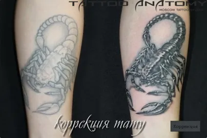 корекція татуювань