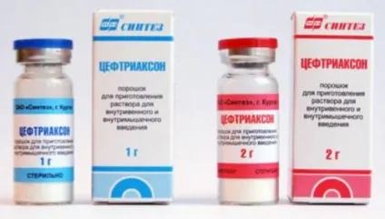 Лакунарна ангіна симптоми, лікування у дітей та дорослих, інкубаційний період (ангіна) Лакунарна ангіна симптоми, лікування у дітей та дорослих, інкубаційний період