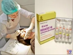 Лікування халязиона - звичайне, оперативне, народне, гомеопатія (гомеопатія) Лікування халязиона - звичайне, оперативне, народне, гомеопатія