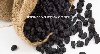 Лікування піску в нирках народними засобами (народними) Лікування піску в нирках народними засобами