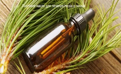 Лікування піску в нирках народними засобами (лікування) Лікування піску в нирках народними засобами