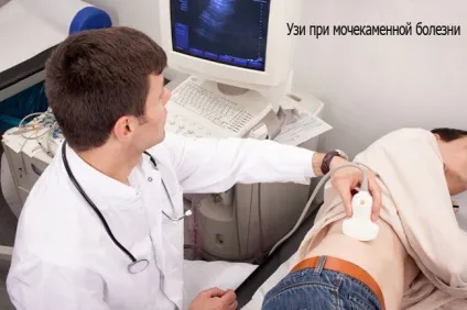 Лікування піску в нирках народними засобами (засобами) Лікування піску в нирках народними засобами
