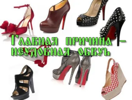 Лікування мокрій або водяний мозолі - проблема літа, лікування в домашніх умовах (водяний) Лікування мокрій або водяний мозолі - проблема літа, лікування в домашніх умовах