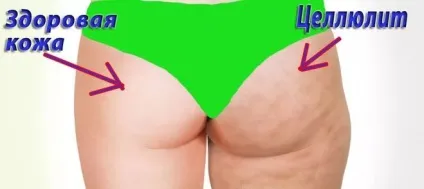 Як зміцнити шкіру людини