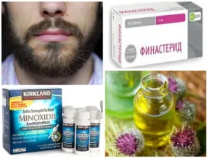Чи не росте волосся на обличчі чоловіка причини і способи боротьби (ростуть) Чи не росте волосся на обличчі чоловіка причини і способи боротьби