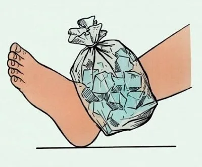 Ноги набрякають до вечора причини, способи позбавлення (вечора) Ноги набрякають до вечора причини, способи позбавлення