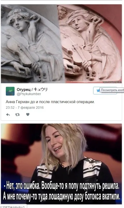 Нова зовнішність Анни герман після пластичної операції (після) Нова зовнішність Анни герман після пластичної операції