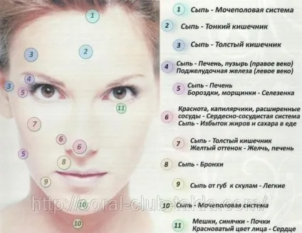 Визначення хвороби по обличчю
