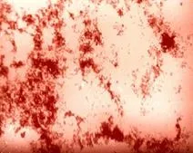 Лабораторна діагностика бруцельозу - студопедія (бруцельозу Brucella melitensis) Лабораторна діагностика бруцельозу - студопедія