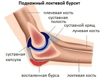 Медичний налокітники - лікувальні властивості і застосування (досягається рахунок використання) Медичний налокітники - лікувальні властивості і застосування