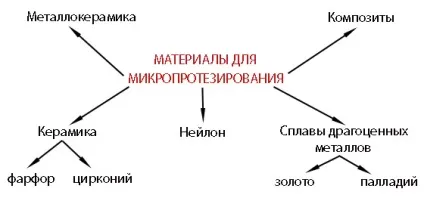Мікропротезування - вкладки та інші види мікропротезів, ціни - стоматологічний портал (інші) Мікропротезування - вкладки та інші види мікропротезів, ціни - стоматологічний портал