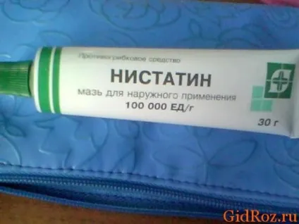 Мазь від потнички у дітей, пітниця у дітей (пітниця) Мазь від потнички у дітей, пітниця у дітей