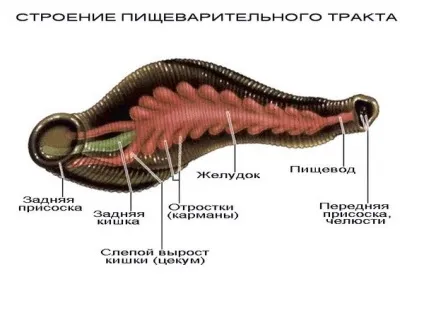 Чи можуть п'явки лікувати псоріаз; думка лікарів