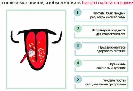 Наліт на мові причини, лікування і профілактика (наліт на язиці: причини) Наліт на мові причини, лікування і профілактика