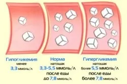 Нормальний рівень цукру в крові у дорослих і дітей, гіперглікемія і гіпоглікемія (крові) Нормальний рівень цукру в крові у дорослих і дітей, гіперглікемія і гіпоглікемія