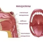 Профілактика тонзиліту у дорослих (профілактика) Профілактика тонзиліту у дорослих