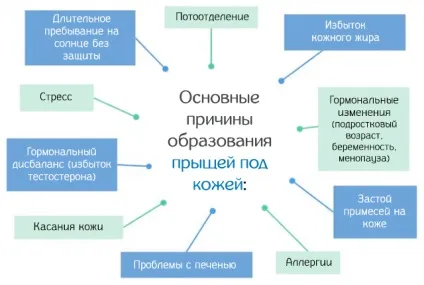 Прищі під шкірою - причини і способи їх видалення (прищі) Прищі під шкірою - причини і способи їх видалення
