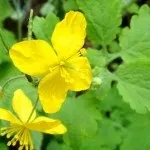 Оперізуючий лишай заразний чи ні, як передається захворювання, профілактика (передається) Оперізуючий лишай заразний чи ні, як передається захворювання, профілактика