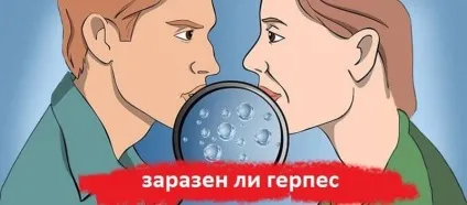 Оперізуючий лишай заразний чи ні для оточуючих (вірусу вітряної віспи) Оперізуючий лишай заразний чи ні для оточуючих