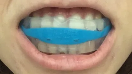 Відділення ортопедичної стоматології (відділення) Відділення ортопедичної стоматології