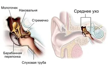 Отит - причини, симптоми, діагностика та лікування (діагностика) Отит - причини, симптоми, діагностика та лікування
