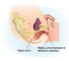 Паренхіматозний простатит - це складне і небезпечне захворювання (паренхіматозний) Паренхіматозний простатит - це складне і небезпечне захворювання