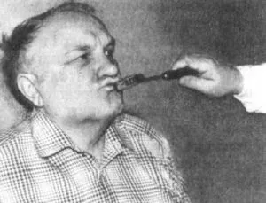 Патологічні рефлекси (Бабинського, Россолімо, Оппенгейма та інші) як перевіряються і на що (патологічні) Патологічні рефлекси (Бабинського, Россолімо, Оппенгейма та інші) як перевіряються і на що