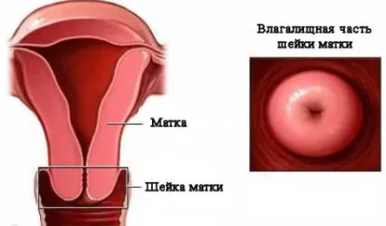 Патологія шийки матки (патологія) Патологія шийки матки