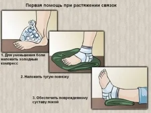 Перша допомога при розтягуванні зв'язок алгоритм дій (допомога) Перша допомога при розтягуванні зв'язок алгоритм дій