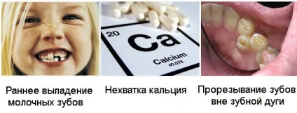Перехресний прикус профілактика і лікування у дітей та дорослих (профілактика) Перехресний прикус профілактика і лікування у дітей та дорослих