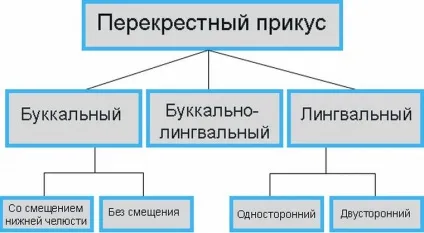 Перехресний прикус у дорослих і дітей лікування, виправлення, фото патології (перехресний прикус зі зміщенням нижньої щелепи) Перехресний прикус у дорослих і дітей лікування, виправлення, фото патології
