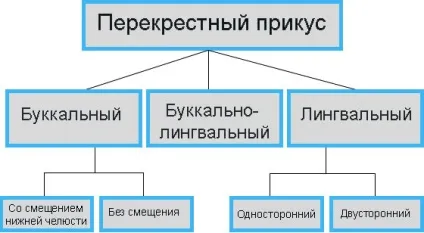 Перехресний прикус профілактика і лікування у дітей та дорослих (дітей) Перехресний прикус профілактика і лікування у дітей та дорослих