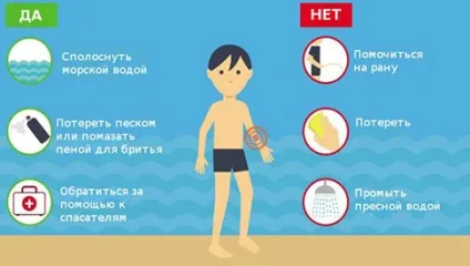Перша допомога при укусі медузи допомагаємо собі і оточуючим (перша) Перша допомога при укусі медузи допомагаємо собі і оточуючим