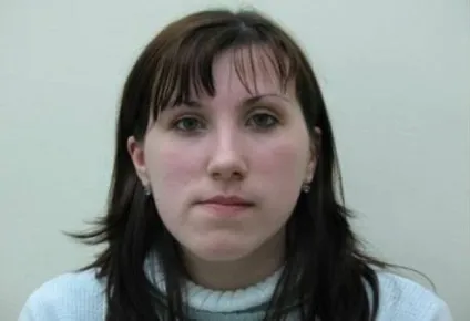 Перехресний прикус види, методи лікування, відгуки
