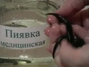 П'явки при гіпертонії - основні правила процедури (банку вузькою шийкою) П'явки при гіпертонії - основні правила процедури