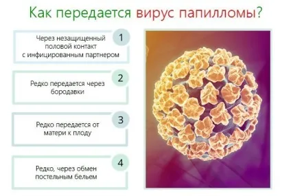 Плоскі бородавки на обличчі причини, лікування, відгуки (плоскі) Плоскі бородавки на обличчі причини, лікування, відгуки