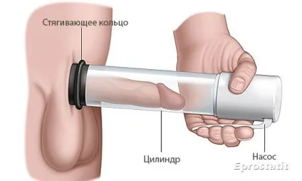 Чому слабка ерекція - нестабільна, неповна, причини, вранці (слабка) Чому слабка ерекція - нестабільна, неповна, причини, вранці